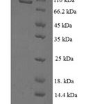 SDS-PAGE separation of QP6534 followed by commassie total protein stain results in a primary band consistent with reported data for PROS1  / . These data demonstrate Greater than 90% as determined by SDS-PAGE.