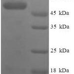 SDS-PAGE separation of QP6538 followed by commassie total protein stain results in a primary band consistent with reported data for Serine protease 23. These data demonstrate Greater than 90% as determined by SDS-PAGE.