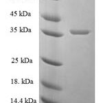 SDS-PAGE separation of QP6540 followed by commassie total protein stain results in a primary band consistent with reported data for PSAP / Prosaposin. These data demonstrate Greater than 90% as determined by SDS-PAGE.