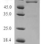 SDS-PAGE separation of QP6547 followed by commassie total protein stain results in a primary band consistent with reported data for PA28A / PSME1. These data demonstrate Greater than 80% as determined by SDS-PAGE.