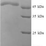 SDS-PAGE separation of QP6548 followed by commassie total protein stain results in a primary band consistent with reported data for Phosphoserine phosphatase. These data demonstrate Greater than 90% as determined by SDS-PAGE.