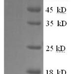 SDS-PAGE separation of QP6551 followed by commassie total protein stain results in a primary band consistent with reported data for PTGS2 / COX2 / PGHS-2. These data demonstrate Greater than 90% as determined by SDS-PAGE.