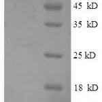 SDS-PAGE separation of QP6561 followed by commassie total protein stain results in a primary band consistent with reported data for Glycogen phosphorylase