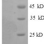 SDS-PAGE separation of QP6562 followed by commassie total protein stain results in a primary band consistent with reported data for Glycogen phosphorylase