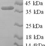 SDS-PAGE separation of QP6563 followed by commassie total protein stain results in a primary band consistent with reported data for Pregnancy zone protein. These data demonstrate Greater than 90% as determined by SDS-PAGE.