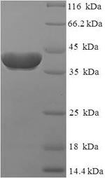 SDS-PAGE separation of QP6569 followed by commassie total protein stain results in a primary band consistent with reported data for RAB2A. These data demonstrate Greater than 90% as determined by SDS-PAGE.