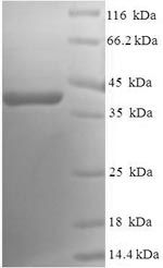 SDS-PAGE separation of QP6571 followed by commassie total protein stain results in a primary band consistent with reported data for Ras-related protein Rab-5A. These data demonstrate Greater than 90% as determined by SDS-PAGE.