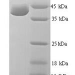 SDS-PAGE separation of QP6578 followed by commassie total protein stain results in a primary band consistent with reported data for UV excision repair protein RAD23 homolog A. These data demonstrate Greater than 80% as determined by SDS-PAGE.