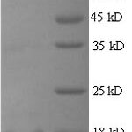 SDS-PAGE separation of QP6595 followed by commassie total protein stain results in a primary band consistent with reported data for REG3G / PAP1B. These data demonstrate Greater than 90% as determined by SDS-PAGE.