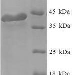 SDS-PAGE separation of QP6603 followed by commassie total protein stain results in a primary band consistent with reported data for Regulator of G-protein signaling 2. These data demonstrate Greater than 90% as determined by SDS-PAGE.