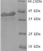 SDS-PAGE separation of QP6603 followed by commassie total protein stain results in a primary band consistent with reported data for Regulator of G-protein signaling 2. These data demonstrate Greater than 90% as determined by SDS-PAGE.