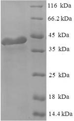 SDS-PAGE separation of QP6603 followed by commassie total protein stain results in a primary band consistent with reported data for Regulator of G-protein signaling 2. These data demonstrate Greater than 90% as determined by SDS-PAGE.