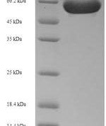 SDS-PAGE separation of QP6609 followed by commassie total protein stain results in a primary band consistent with reported data for RIPK2. These data demonstrate Greater than 90% as determined by SDS-PAGE.