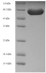 SDS-PAGE separation of QP6609 followed by commassie total protein stain results in a primary band consistent with reported data for RIPK2. These data demonstrate Greater than 90% as determined by SDS-PAGE.