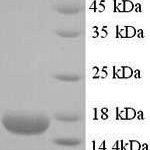 SDS-PAGE separation of QP6614 followed by commassie total protein stain results in a primary band consistent with reported data for Ropporin-1B. These data demonstrate Greater than 90% as determined by SDS-PAGE.