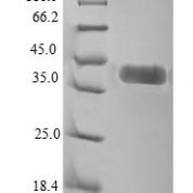 SDS-PAGE separation of QP6615 followed by commassie total protein stain results in a primary band consistent with reported data for ROR1. These data demonstrate Greater than 90% as determined by SDS-PAGE.