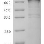 SDS-PAGE separation of QP6618 followed by commassie total protein stain results in a primary band consistent with reported data for RPA1. These data demonstrate Greater than 90% as determined by SDS-PAGE.