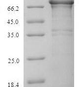 SDS-PAGE separation of QP6618 followed by commassie total protein stain results in a primary band consistent with reported data for RPA1. These data demonstrate Greater than 90% as determined by SDS-PAGE.