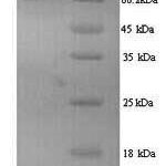 SDS-PAGE separation of QP6629 followed by commassie total protein stain results in a primary band consistent with reported data for RRM1. These data demonstrate Greater than 90% as determined by SDS-PAGE.