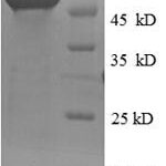 SDS-PAGE separation of QP6630 followed by commassie total protein stain results in a primary band consistent with reported data for RRM2. These data demonstrate Greater than 90% as determined by SDS-PAGE.