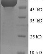SDS-PAGE separation of QP6630 followed by commassie total protein stain results in a primary band consistent with reported data for RRM2. These data demonstrate Greater than 90% as determined by SDS-PAGE.