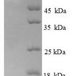 SDS-PAGE separation of QP6633 followed by commassie total protein stain results in a primary band consistent with reported data for Ryanodine receptor 1. These data demonstrate Greater than 90% as determined by SDS-PAGE.