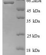 SDS-PAGE separation of QP6633 followed by commassie total protein stain results in a primary band consistent with reported data for Ryanodine receptor 1. These data demonstrate Greater than 90% as determined by SDS-PAGE.
