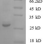 SDS-PAGE separation of QP6636 followed by commassie total protein stain results in a primary band consistent with reported data for S100A11 / S100C. These data demonstrate Greater than 90% as determined by SDS-PAGE.