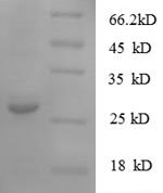 SDS-PAGE separation of QP6636 followed by commassie total protein stain results in a primary band consistent with reported data for S100A11 / S100C. These data demonstrate Greater than 90% as determined by SDS-PAGE.