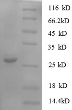 SDS-PAGE separation of QP6636 followed by commassie total protein stain results in a primary band consistent with reported data for S100A11 / S100C. These data demonstrate Greater than 90% as determined by SDS-PAGE.