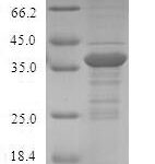 SDS-PAGE separation of QP6637 followed by commassie total protein stain results in a primary band consistent with reported data for S100A12 / CAGC / Calgranulin-C Protein. These data demonstrate Greater than 80% as determined by SDS-PAGE.