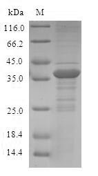 SDS-PAGE separation of QP6637 followed by commassie total protein stain results in a primary band consistent with reported data for S100A12 / CAGC / Calgranulin-C Protein. These data demonstrate Greater than 80% as determined by SDS-PAGE.