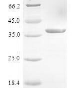 SDS-PAGE separation of QP6638 followed by commassie total protein stain results in a primary band consistent with reported data for S100A3 / S100E. These data demonstrate Greater than 80% as determined by SDS-PAGE.