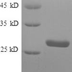 SDS-PAGE separation of QP6639 followed by commassie total protein stain results in a primary band consistent with reported data for S100A4. These data demonstrate Greater than 90% as determined by SDS-PAGE.