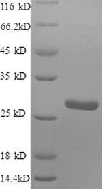 SDS-PAGE separation of QP6639 followed by commassie total protein stain results in a primary band consistent with reported data for S100A4. These data demonstrate Greater than 90% as determined by SDS-PAGE.