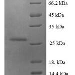 SDS-PAGE separation of QP6640 followed by commassie total protein stain results in a primary band consistent with reported data for S100A6. These data demonstrate Greater than 90% as determined by SDS-PAGE.