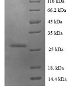 SDS-PAGE separation of QP6640 followed by commassie total protein stain results in a primary band consistent with reported data for S100A6. These data demonstrate Greater than 90% as determined by SDS-PAGE.