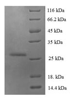 SDS-PAGE separation of QP6640 followed by commassie total protein stain results in a primary band consistent with reported data for S100A6. These data demonstrate Greater than 90% as determined by SDS-PAGE.