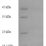 SDS-PAGE separation of QP6642 followed by commassie total protein stain results in a primary band consistent with reported data for S100A8 / CAGA. These data demonstrate Greater than 90% as determined by SDS-PAGE.