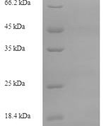 SDS-PAGE separation of QP6642 followed by commassie total protein stain results in a primary band consistent with reported data for S100A8 / CAGA. These data demonstrate Greater than 90% as determined by SDS-PAGE.