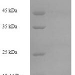 SDS-PAGE separation of QP6645 followed by commassie total protein stain results in a primary band consistent with reported data for Serum amyloid A protein. These data demonstrate Greater than 90% as determined by SDS-PAGE.