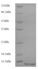 SDS-PAGE separation of QP6645 followed by commassie total protein stain results in a primary band consistent with reported data for Serum amyloid A protein. These data demonstrate Greater than 90% as determined by SDS-PAGE.