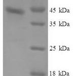 SDS-PAGE separation of QP6646 followed by commassie total protein stain results in a primary band consistent with reported data for Serum amyloid A protein. These data demonstrate Greater than 90% as determined by SDS-PAGE.