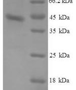 SDS-PAGE separation of QP6646 followed by commassie total protein stain results in a primary band consistent with reported data for Serum amyloid A protein. These data demonstrate Greater than 90% as determined by SDS-PAGE.