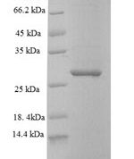 SDS-PAGE separation of QP6650 followed by commassie total protein stain results in a primary band consistent with reported data for SAMHD1. These data demonstrate Greater than 90% as determined by SDS-PAGE.