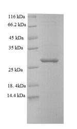 SDS-PAGE separation of QP6650 followed by commassie total protein stain results in a primary band consistent with reported data for SAMHD1. These data demonstrate Greater than 90% as determined by SDS-PAGE.