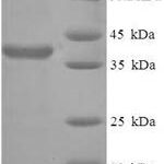 SDS-PAGE separation of QP6652 followed by commassie total protein stain results in a primary band consistent with reported data for Protein SCO2 homolog