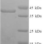 SDS-PAGE separation of QP6655 followed by commassie total protein stain results in a primary band consistent with reported data for Syndecan-1 / SDC1 / CD138. These data demonstrate Greater than 90% as determined by SDS-PAGE.