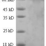 SDS-PAGE separation of QP6659 followed by commassie total protein stain results in a primary band consistent with reported data for SDHA. These data demonstrate Greater than 80% as determined by SDS-PAGE.