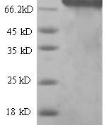 SDS-PAGE separation of QP6659 followed by commassie total protein stain results in a primary band consistent with reported data for SDHA. These data demonstrate Greater than 80% as determined by SDS-PAGE.